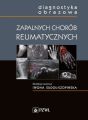 Diagnostyka obrazowa zapalnych chorob reumatycznych