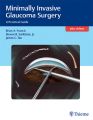 Minimally Invasive Glaucoma Surgery