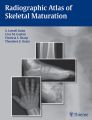 Radiographic Atlas of Skeletal Maturation