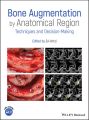 Bone Augmentation by Anatomical Region